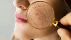 checking skin with magnifying glass